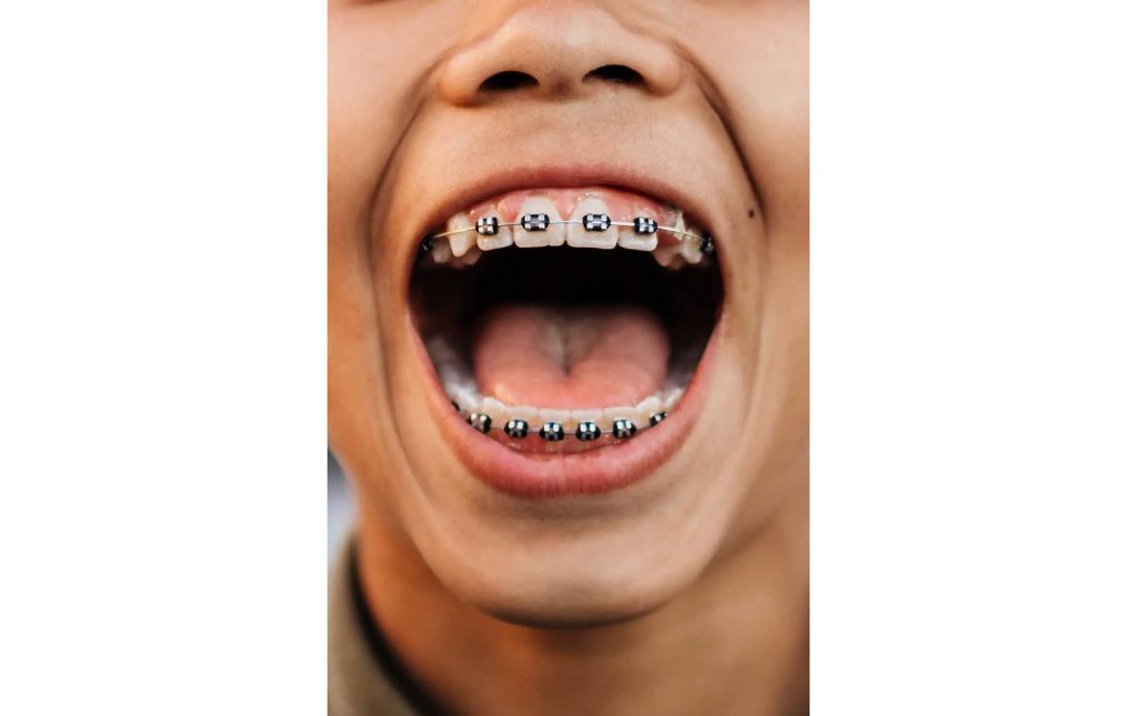 br-IrvdPNXTL thumbnail