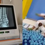 Accidente en área de juegos deja a mujer con severas lesiones en la Ciudad de México